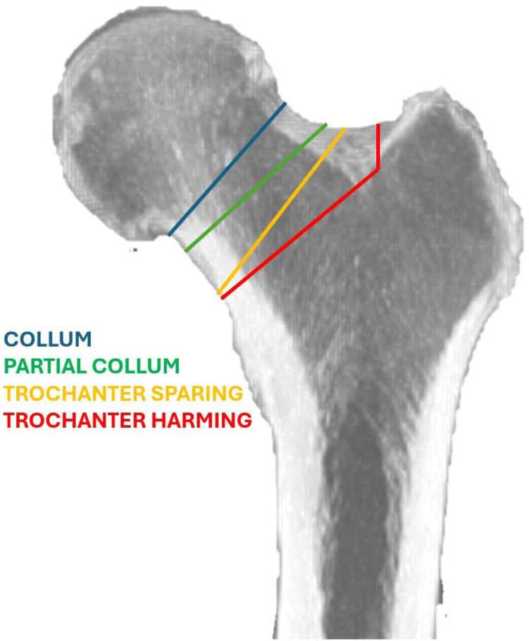 Figure 13