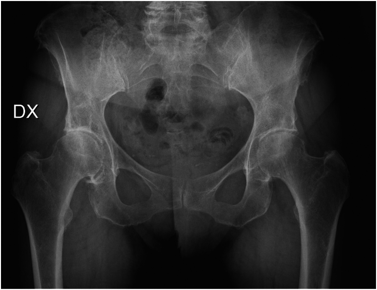 Figure 14
