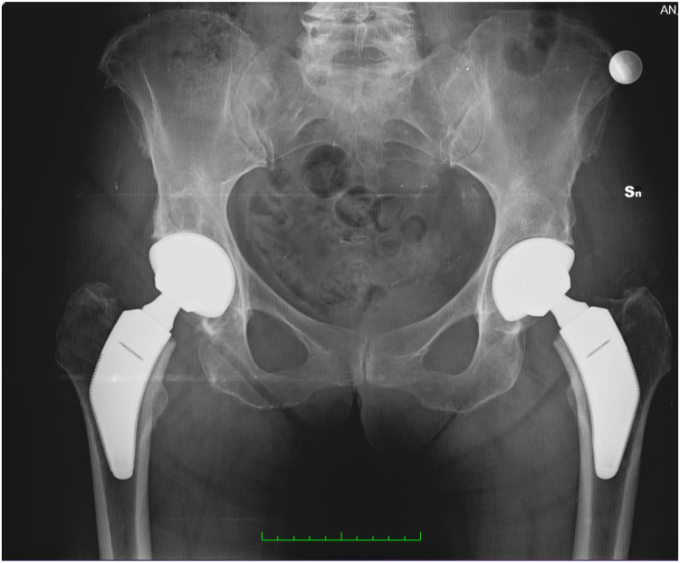 Figure 15