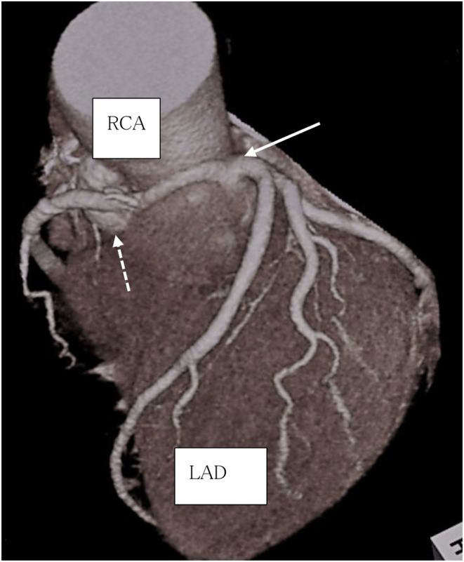FIGURE 1