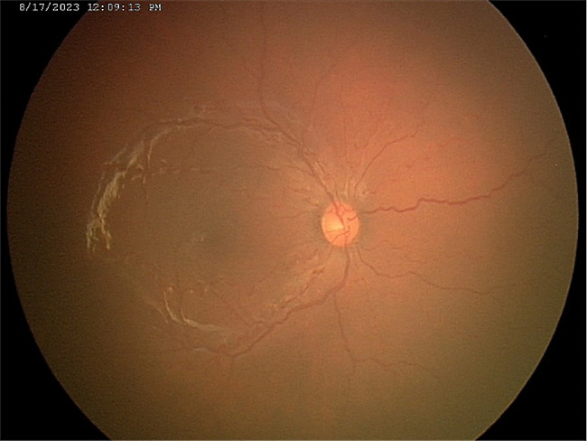 Figure 10