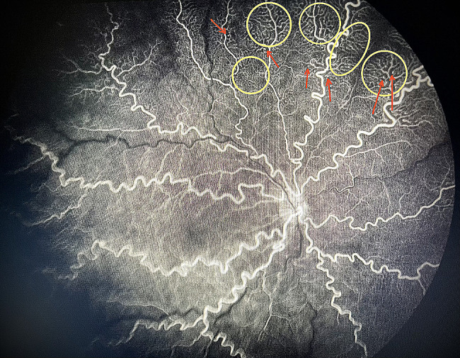 Figure 6