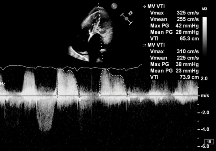 Figure 5