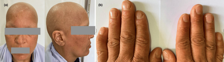 Figure 11