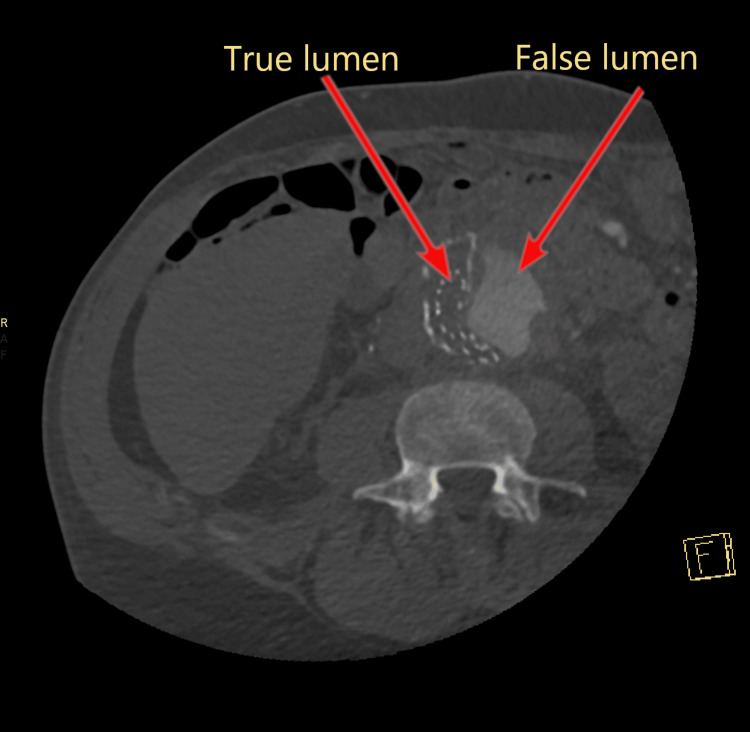 Figure 5