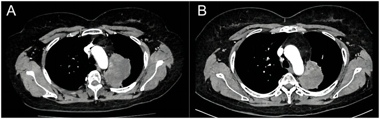 Figure 2