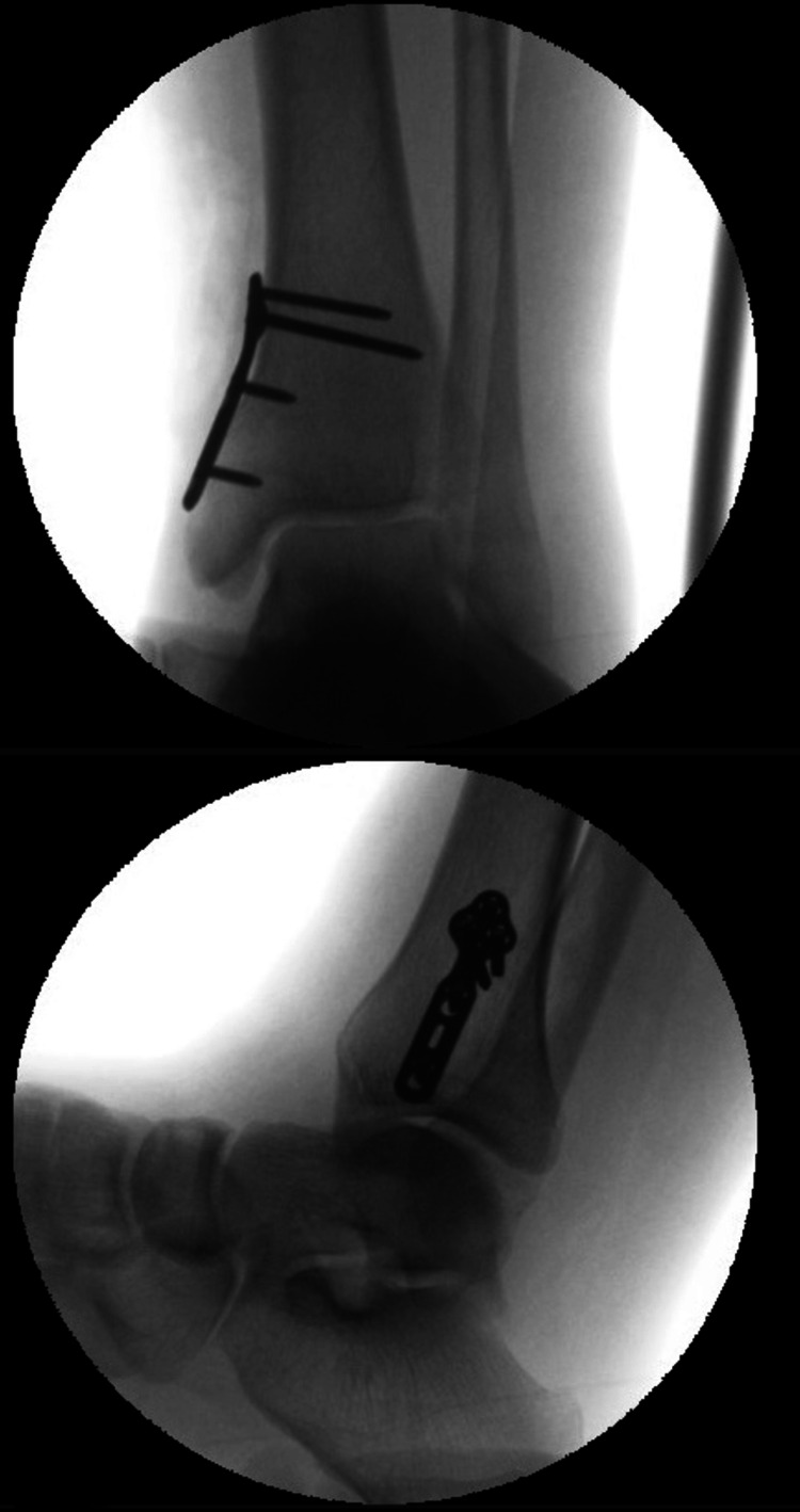 Figure 5