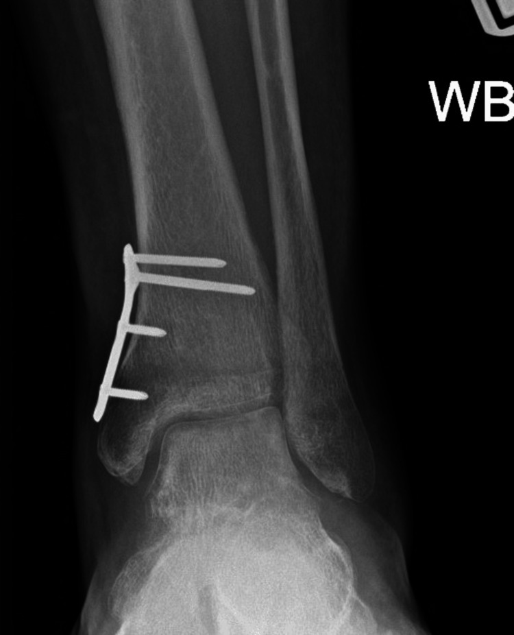 Figure 6