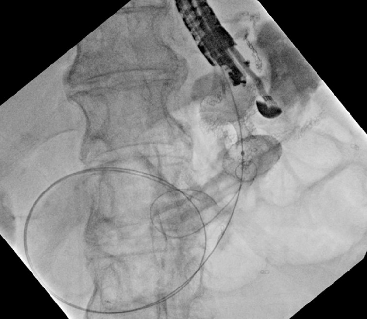 Fig. 3