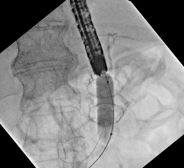 Fig. 4