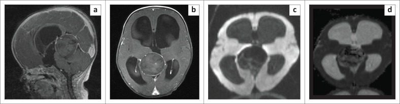 FIGURE 2