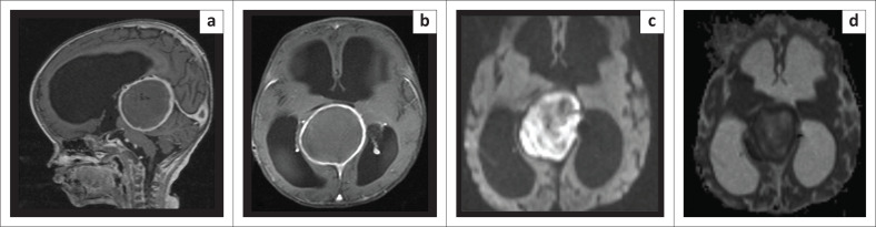 FIGURE 3