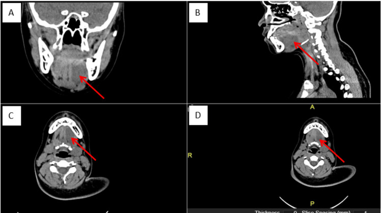 Figure 6