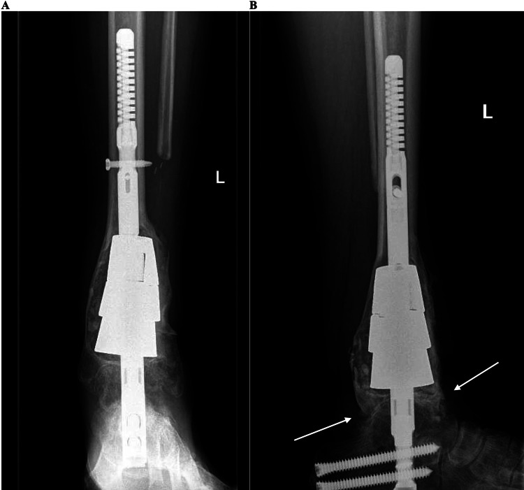 Figure 9