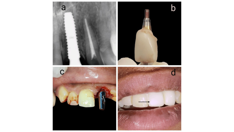 Figure 5