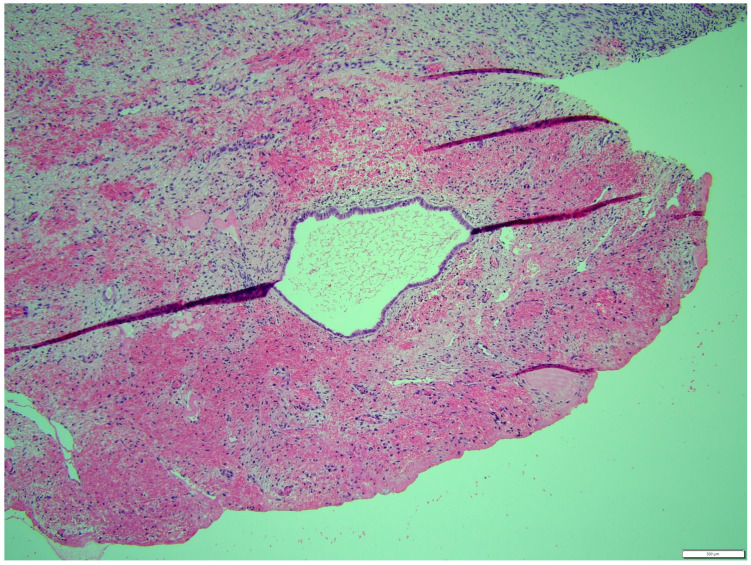 Figure 11