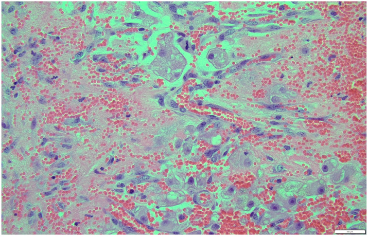 Figure 13