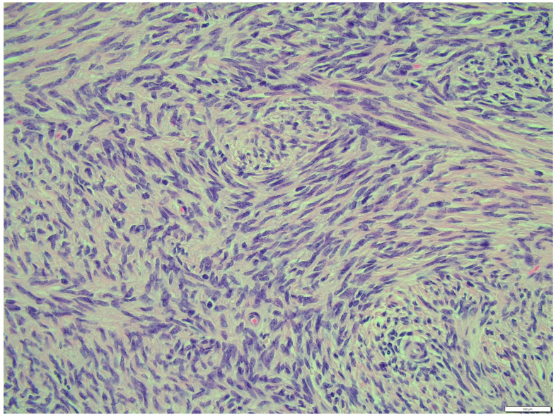 Figure 14
