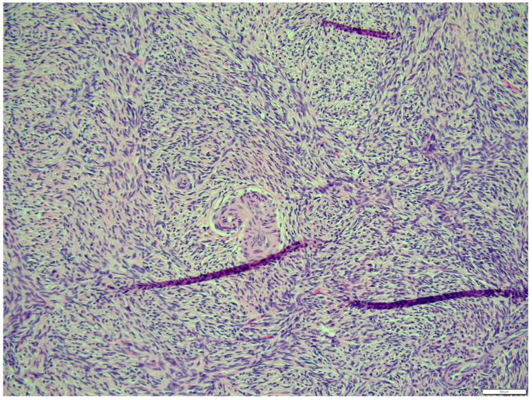 Figure 16
