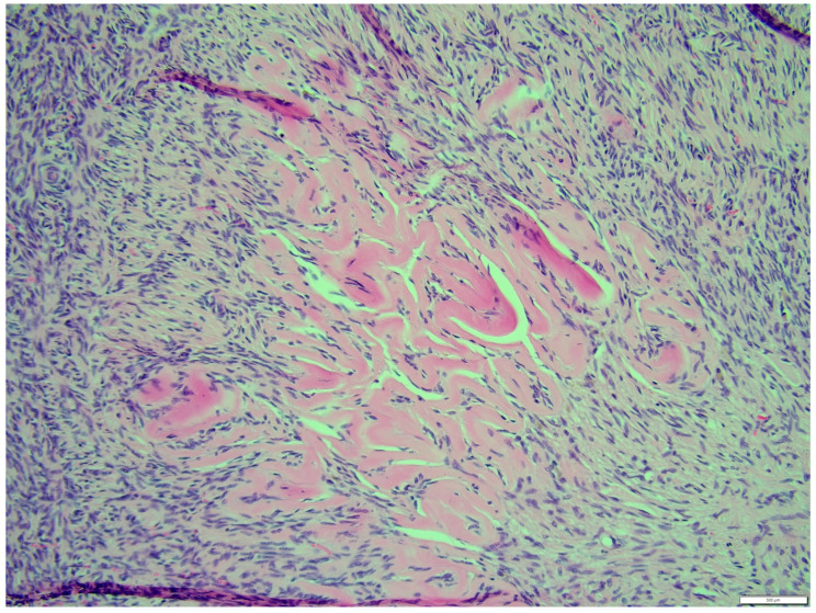 Figure 17