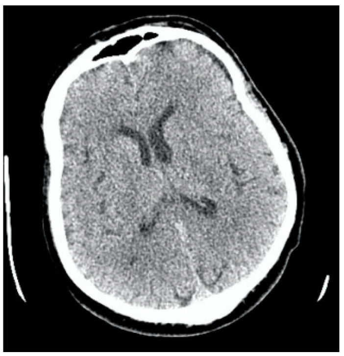 Figure 9