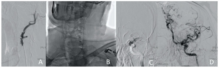 Figure 11