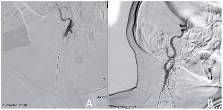 Figure 13