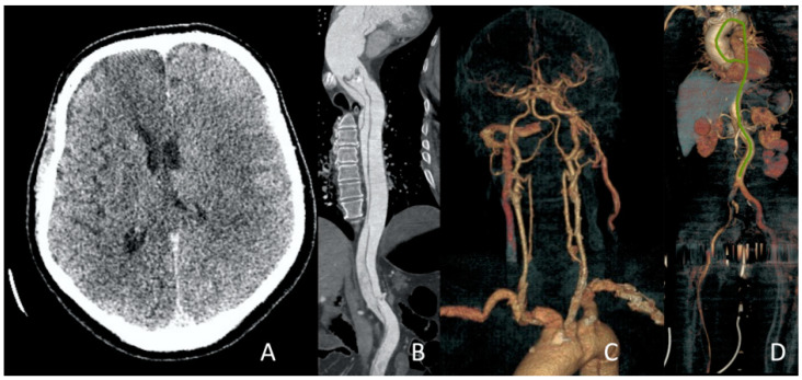 Figure 14