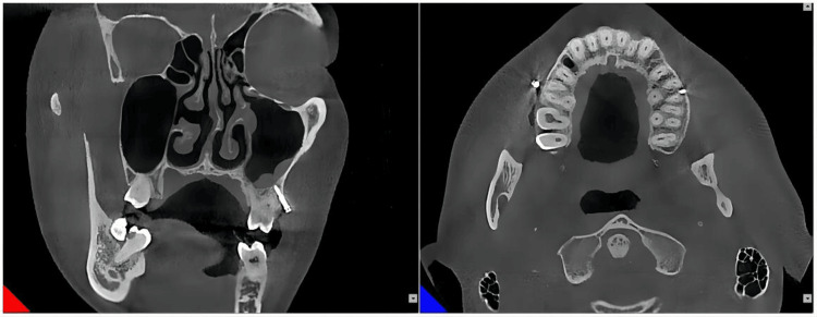 Figure 9
