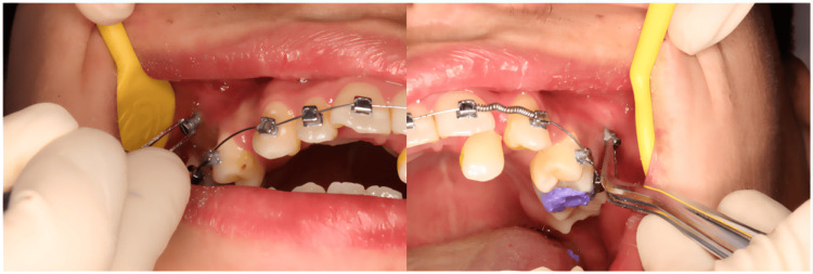 Figure 10