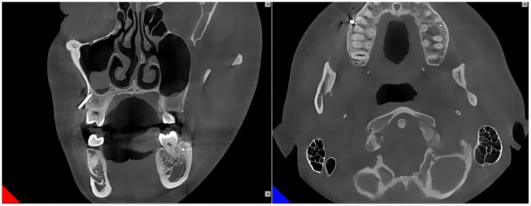 Figure 11
