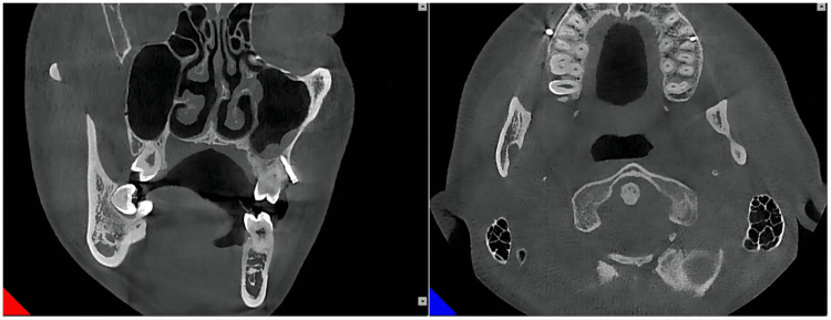 Figure 12