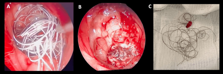 Figure 9