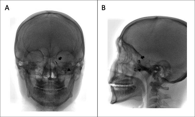 Figure 10