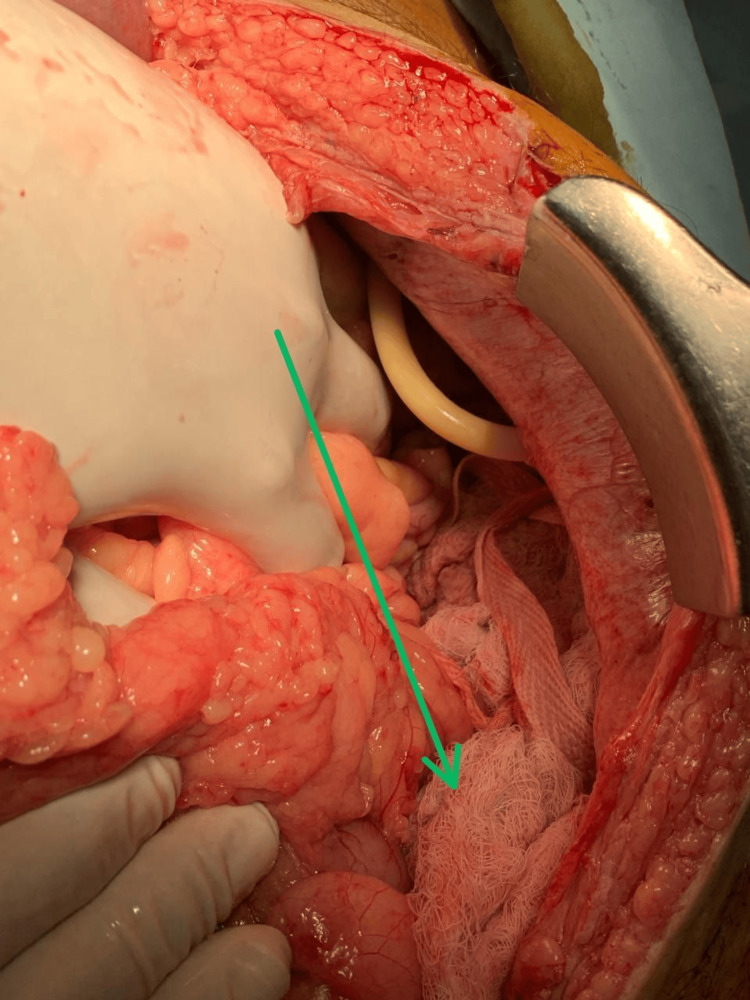 Figure 6