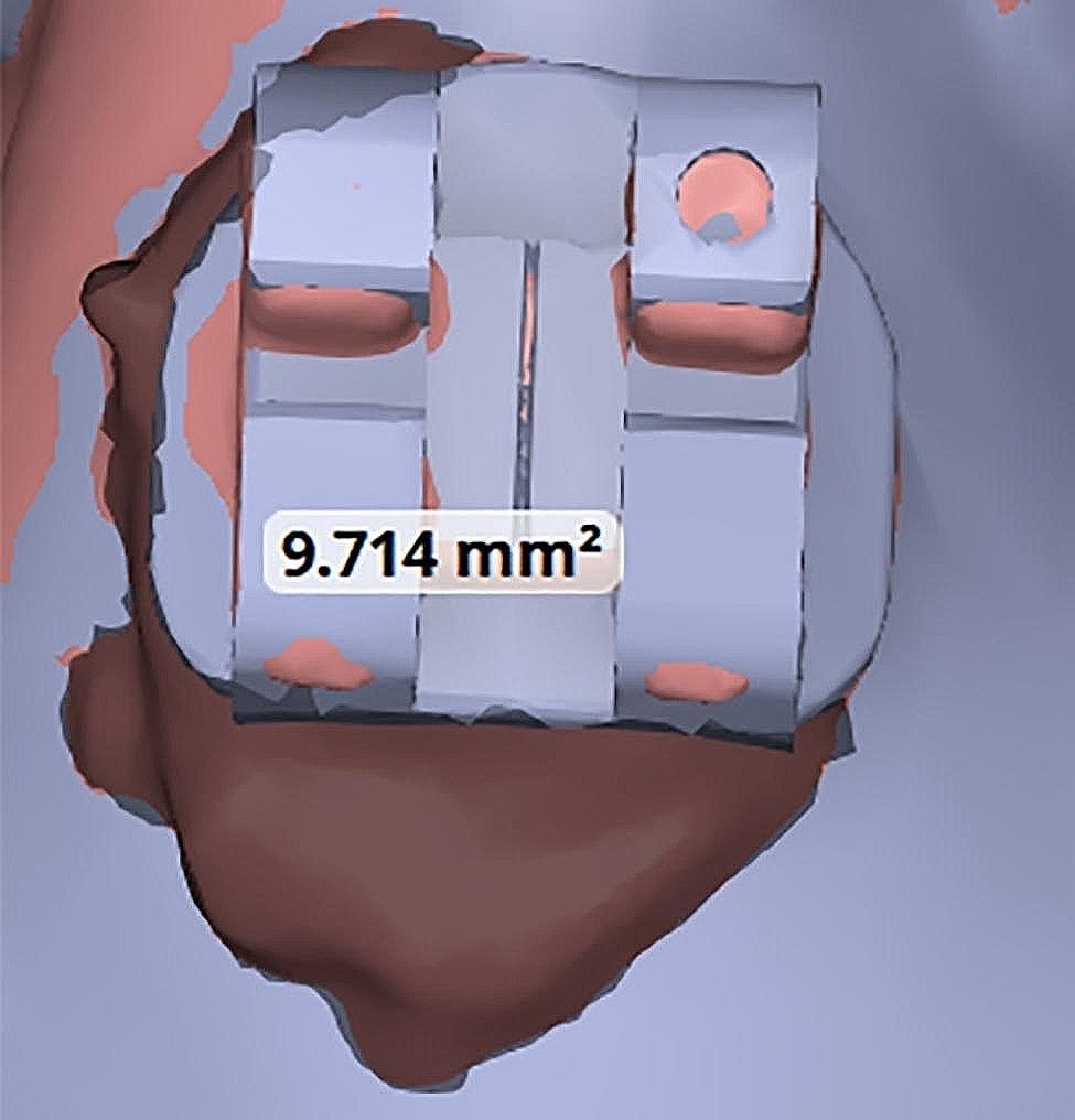 Figure 6