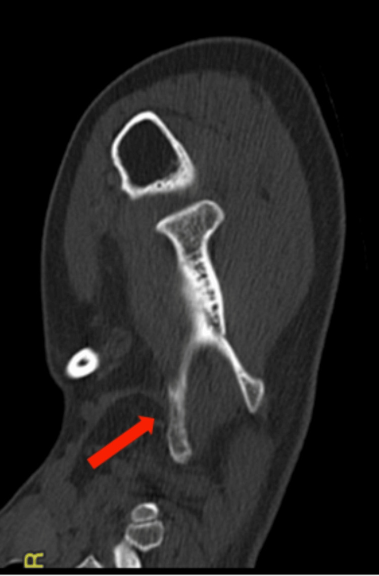 Figure 12
