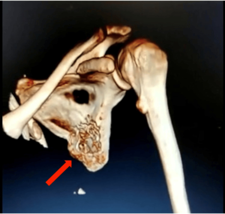 Figure 13