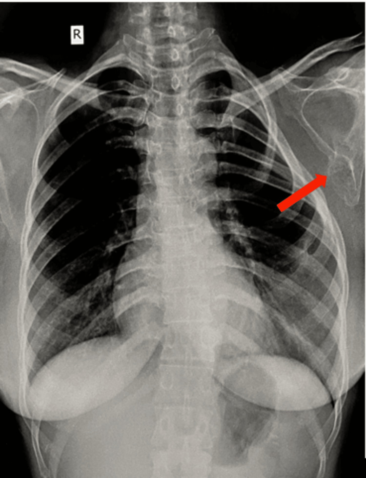 Figure 14