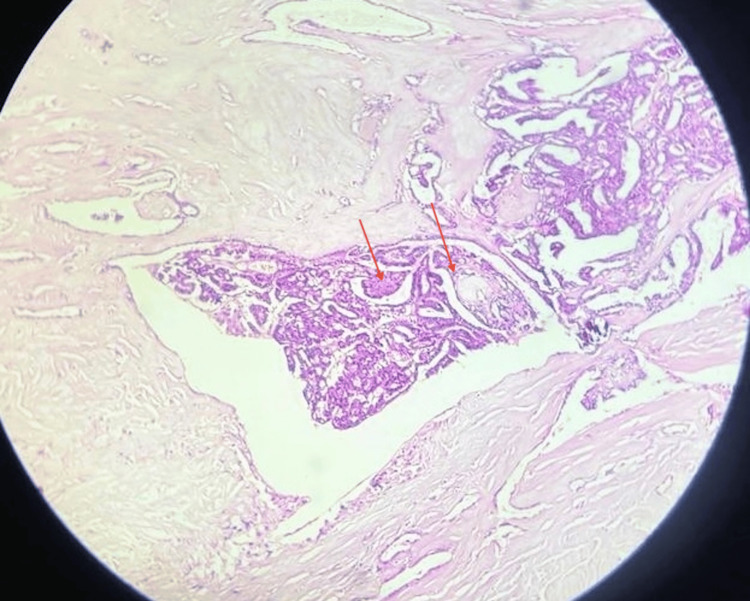Figure 12