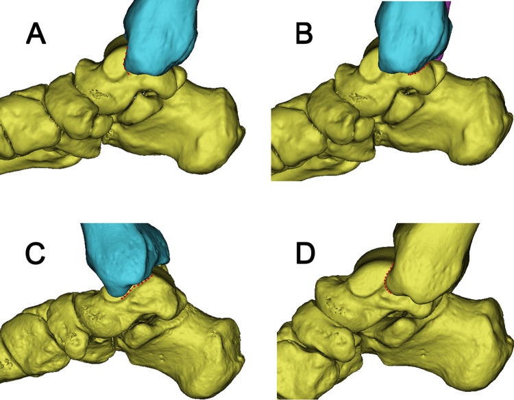 Fig 1