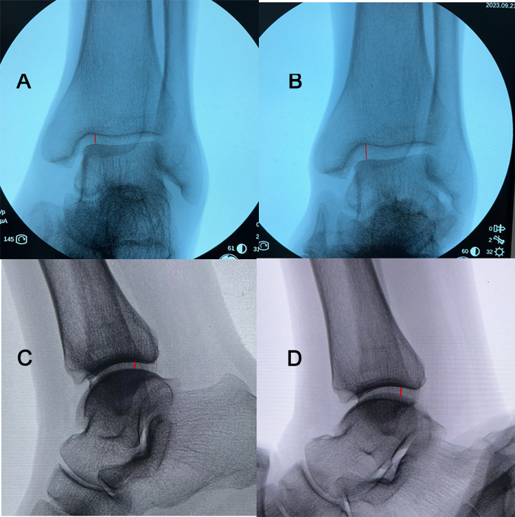 Fig 4