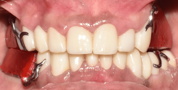 Figure 9