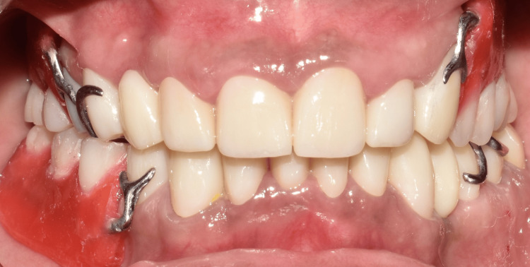 Figure 10