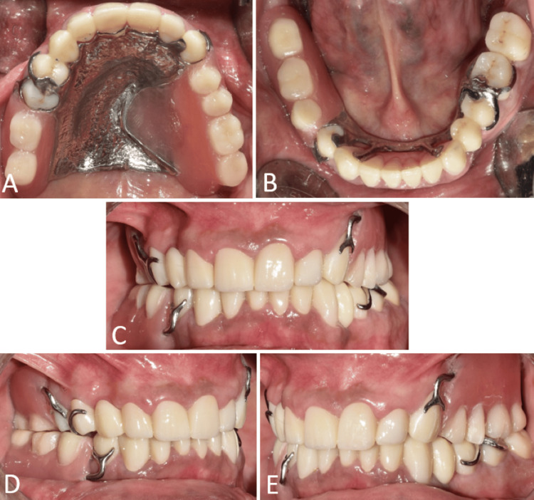 Figure 11