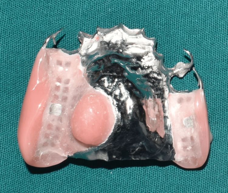 Figure 12
