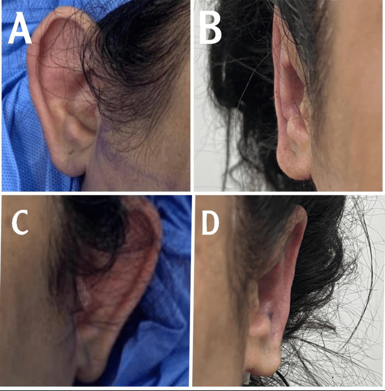 Figure 6