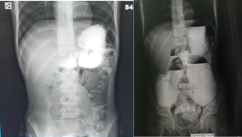 Figure 17