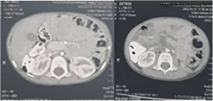 Figure 21