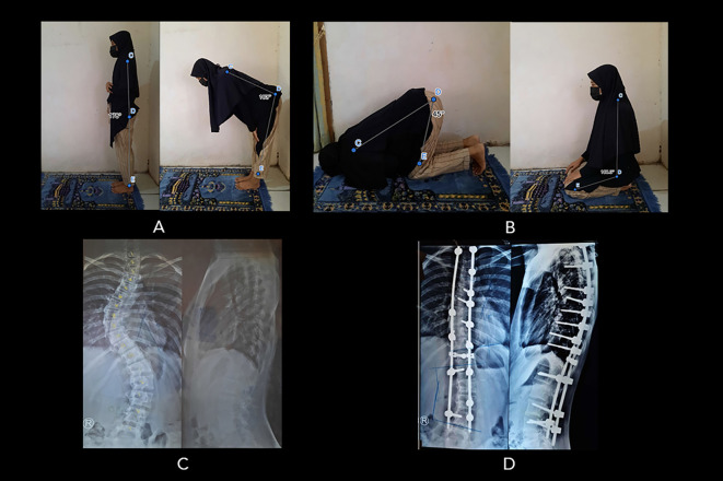 Figure 4